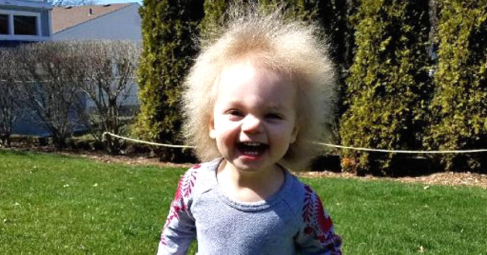 Toddler Nicknamed 'Baby Einstein 2.0' After Being Born with 'UltraRare