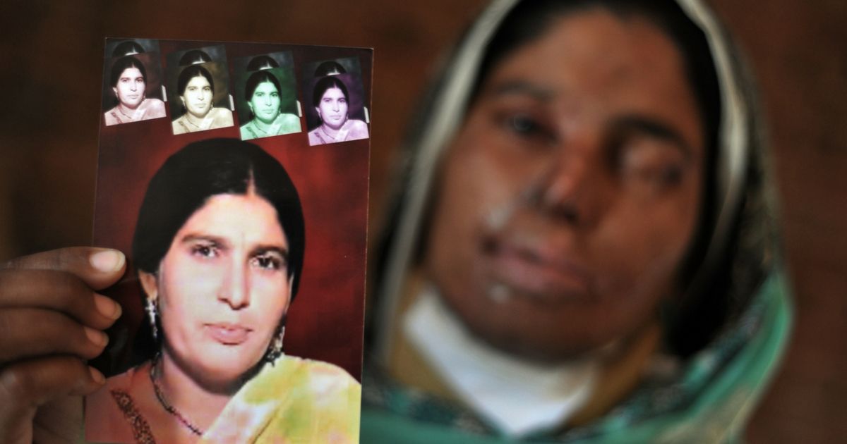 Acid attack victim Asiya Bibe, 35, poses with a portrait before her disfigurement at her residence at Bahawalpur district in Multan on March 16, 2012.