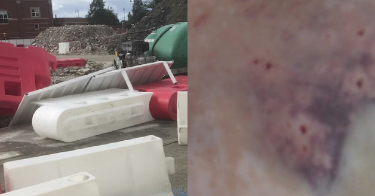 Construction fencing fell on a woman, but she was miraculously saved.