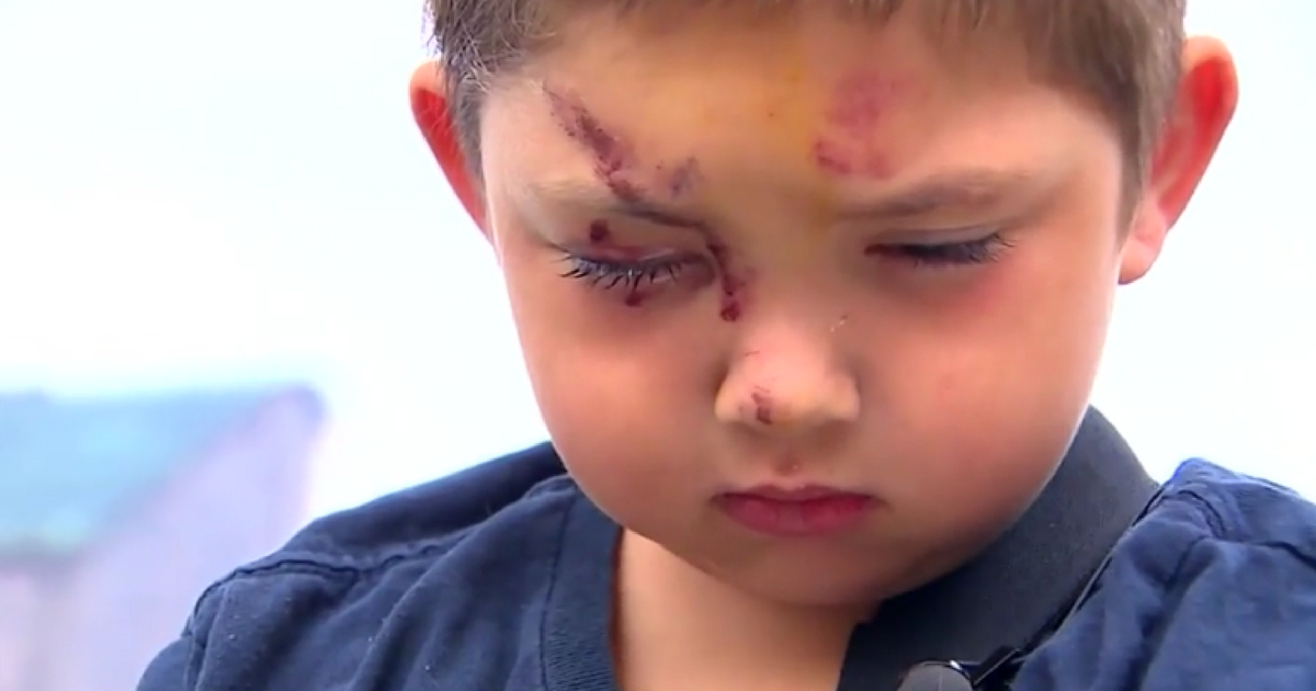 Boy Assaulted by Bullies