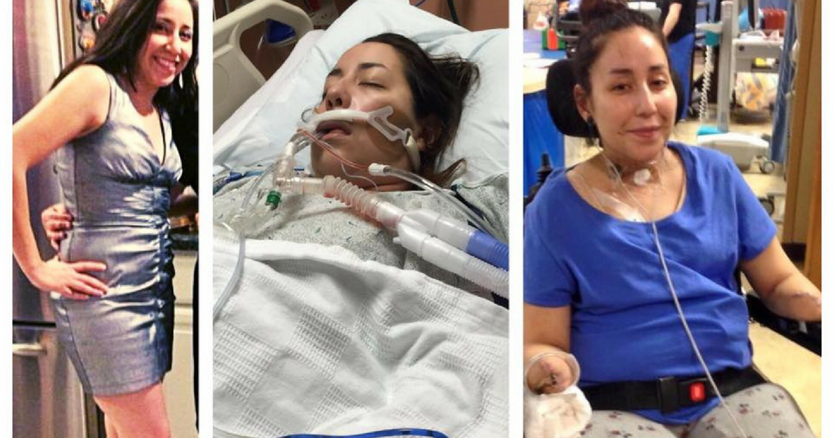After a common cold, this woman went into a coma and septic shock, resulting in a quadruple amputee. But she doesn't let it affect her life, and she still walked down the aisle.