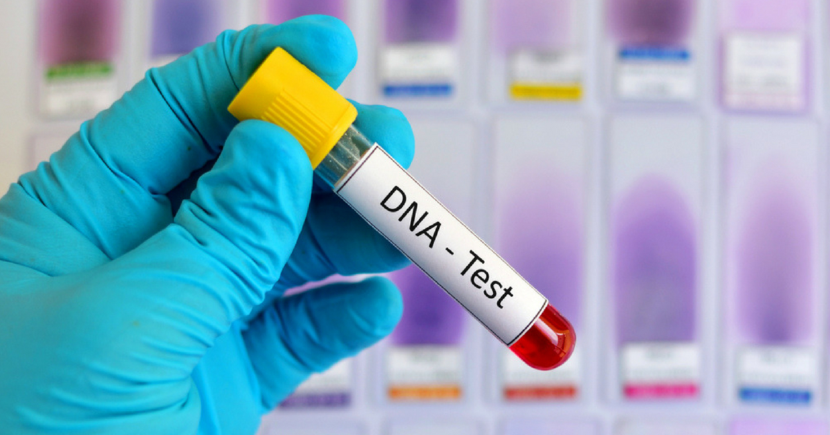 Blood sample for DNA testing.