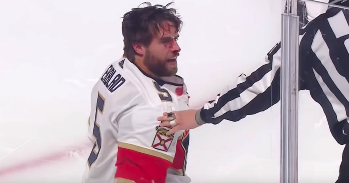 Florida Panthers defenseman Aaron Ekblad bleeds after getting punched by Montreal's Max Domi in a preseason game.
