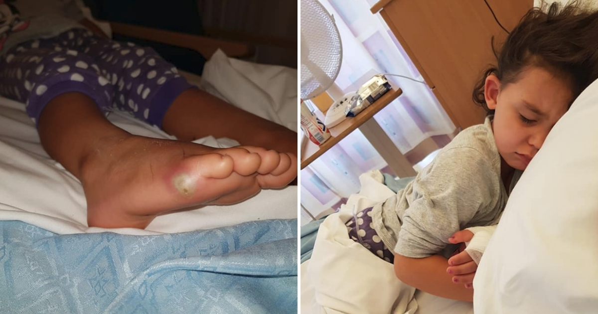 Girl Gets Sepsis from Barefoot in Shoes