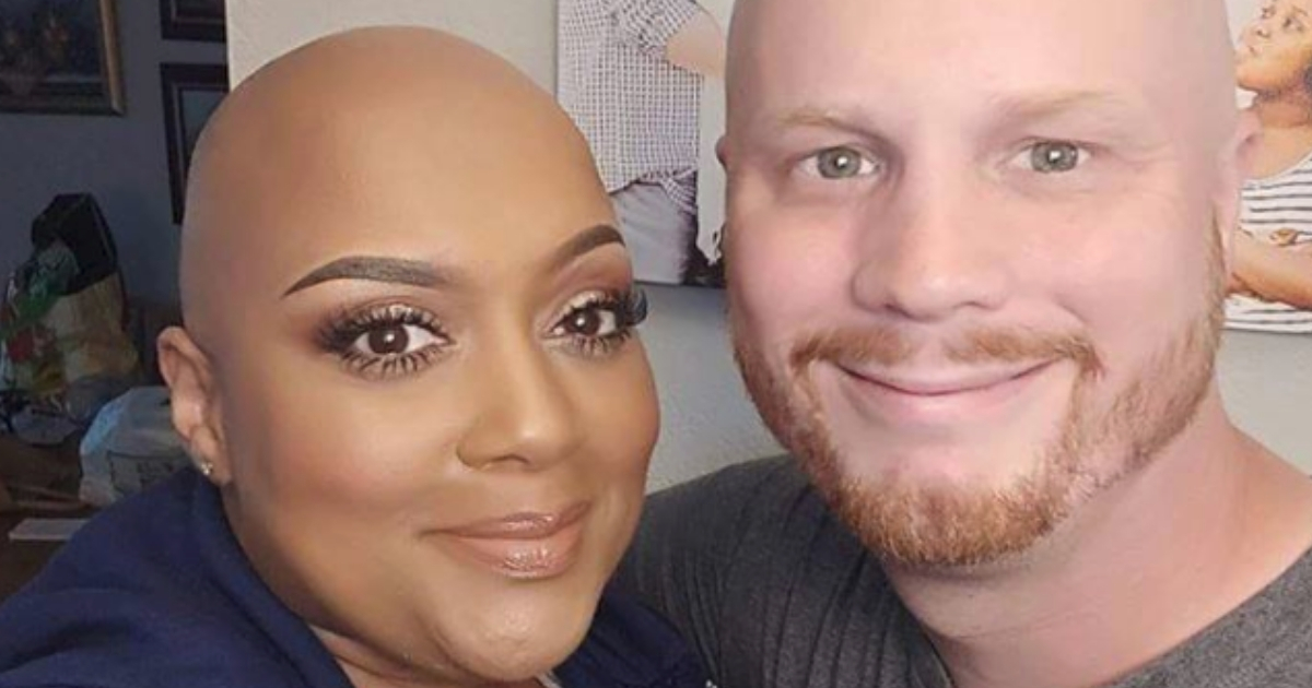 Husband Supports Wife with Alopecia