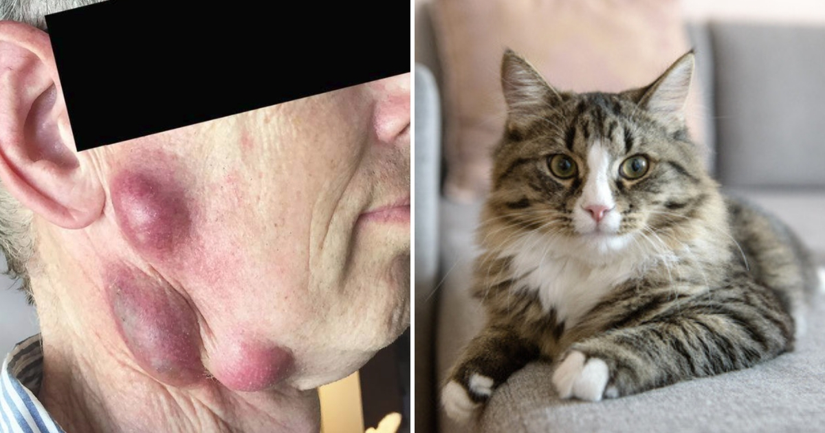 Infection from Cat