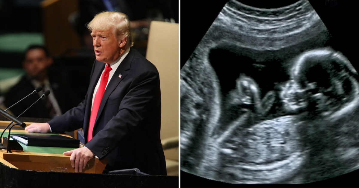 Trump and Ultrasound
