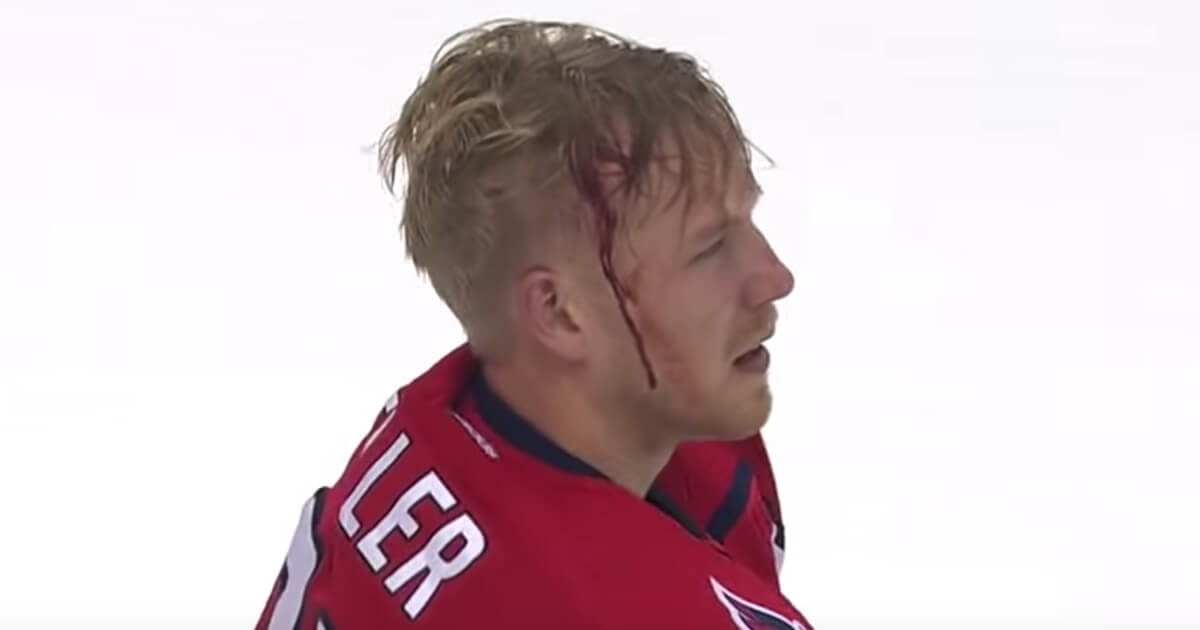 Washington Capitals center Lars Eller was bleeding after being jumped by Boston's Brad Marchand on Wednesday.