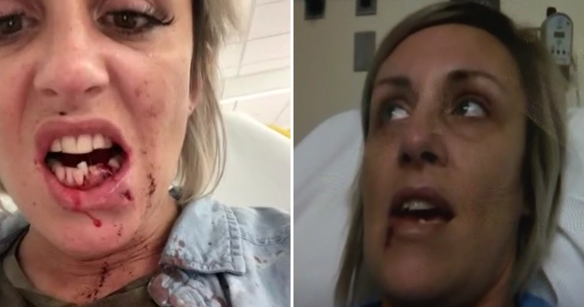 Woman Broken Jaw Road Rage