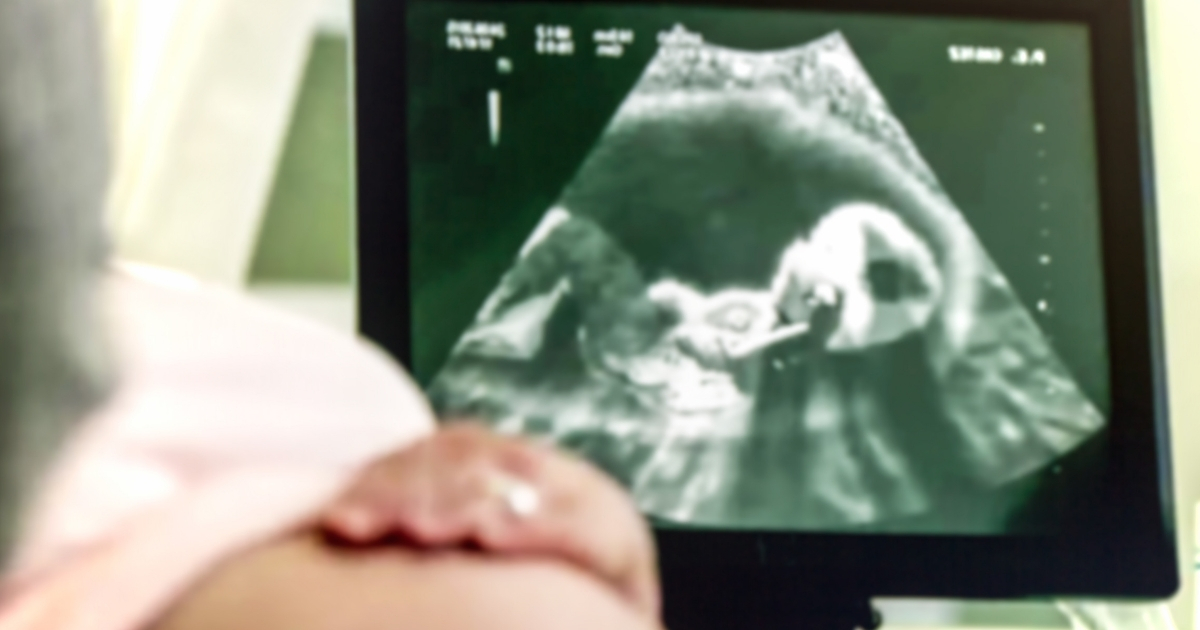 Pregnant woman having ultrasound
