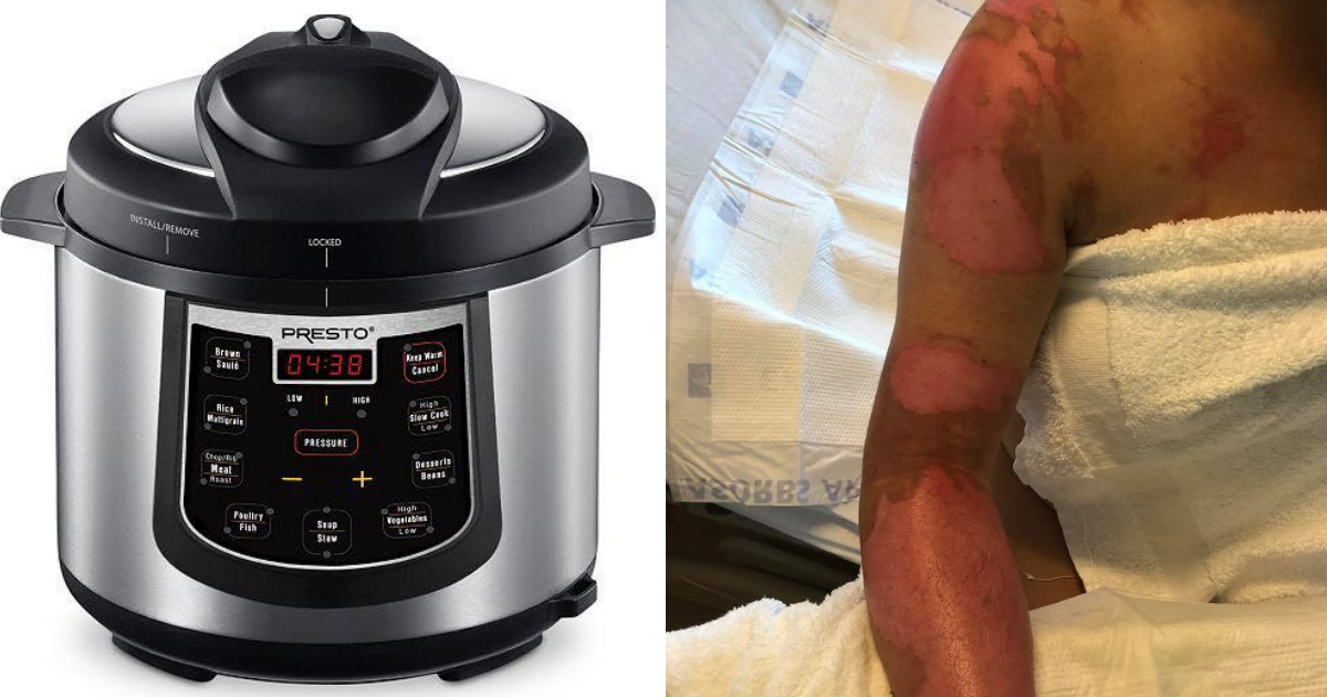 Pressure cooker, left, woman with burns on her arm, right.