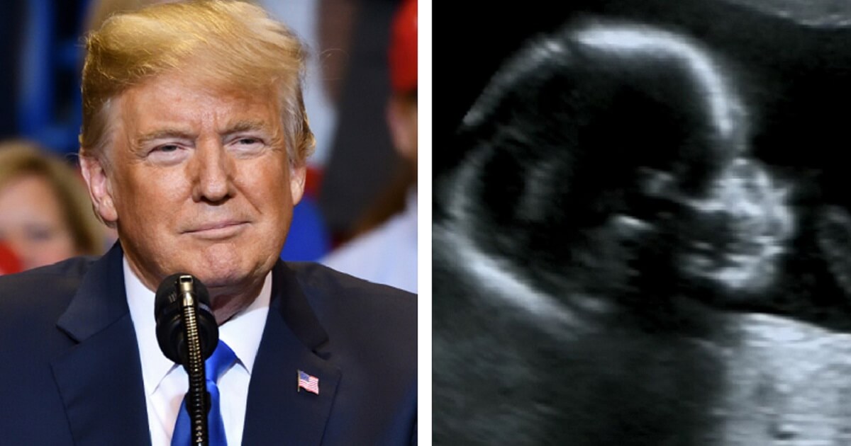 President Donald Trump, left; a sonogram of an infant, right.