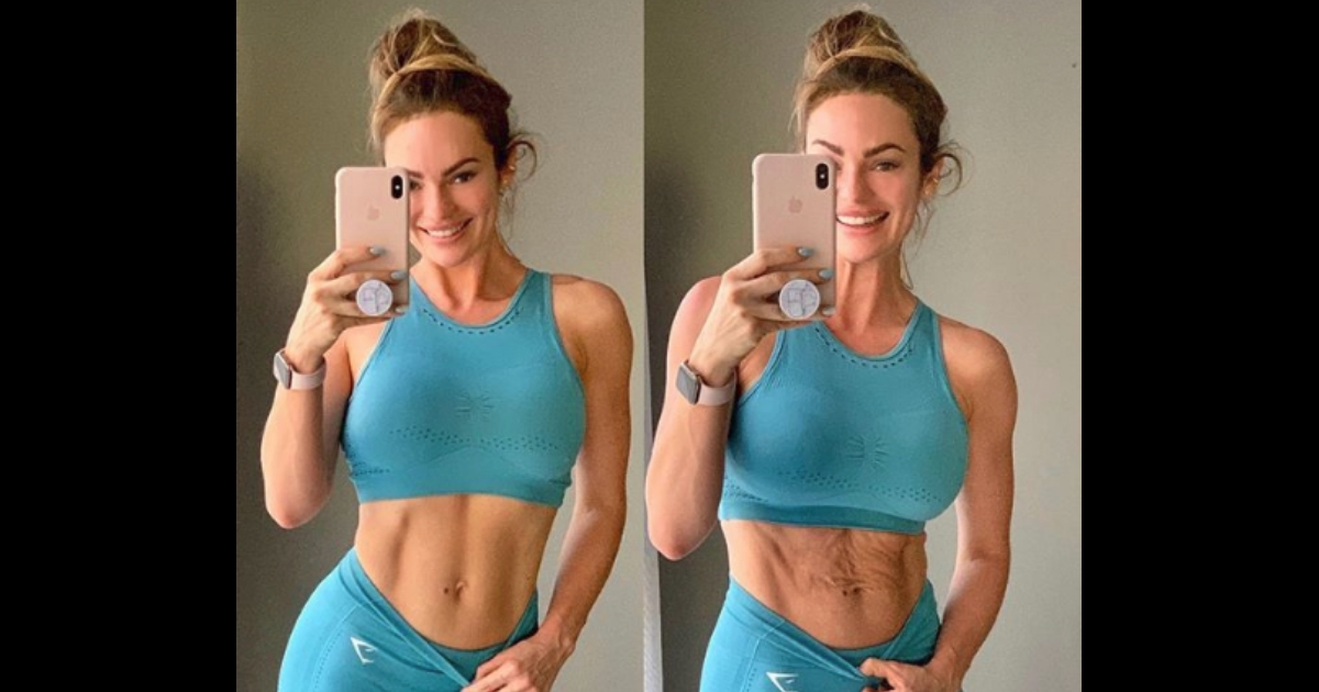 A woman with a toned stomach, left, and her with postpartum wrinkles, right.