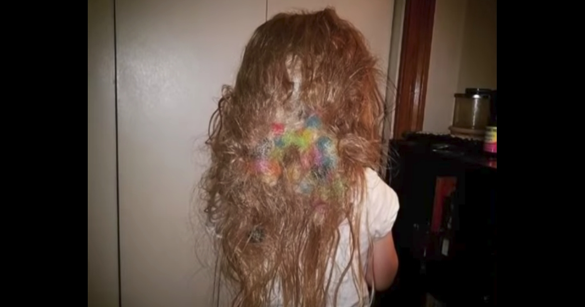 Toy tangled in girl's hair.