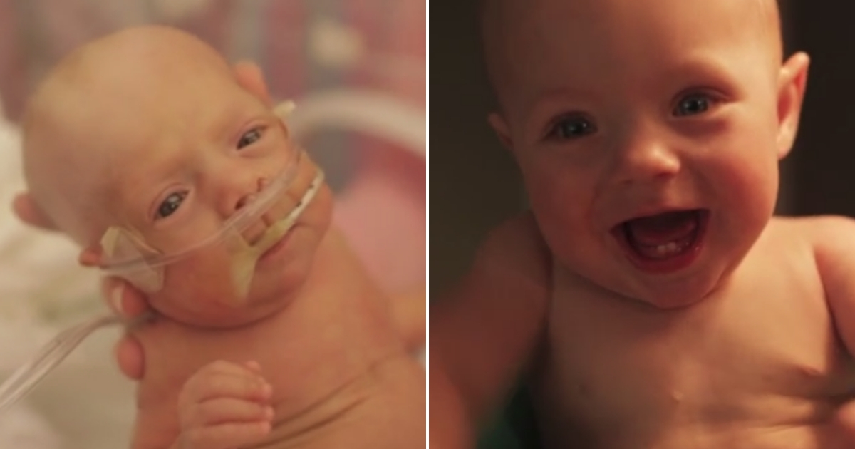 Baby as a preemie, left, and growing, right.