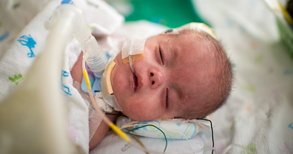 Baby in intensive care