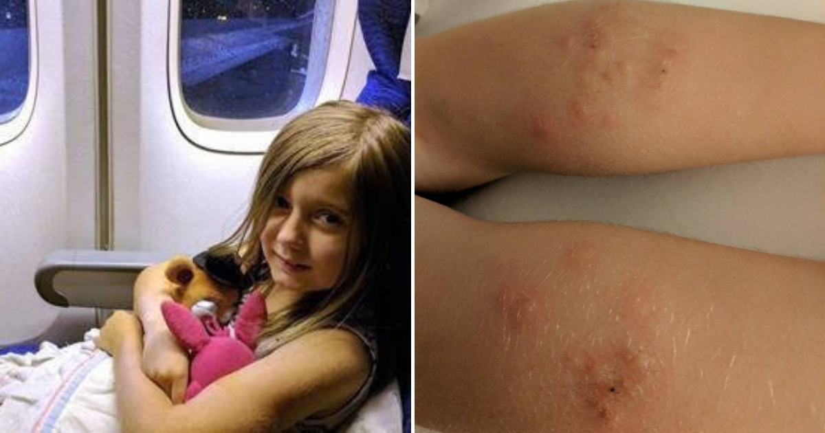 Bed Bugs on Plane