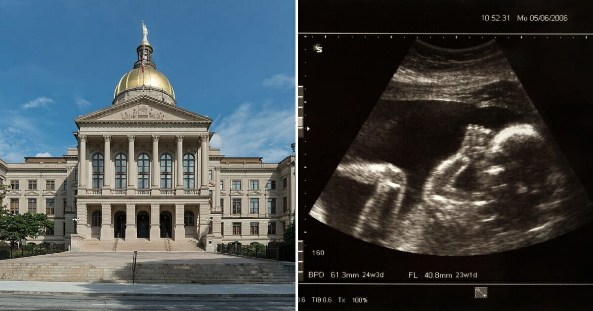 Georgia state capitol building, left, and a baby sonogram, right.