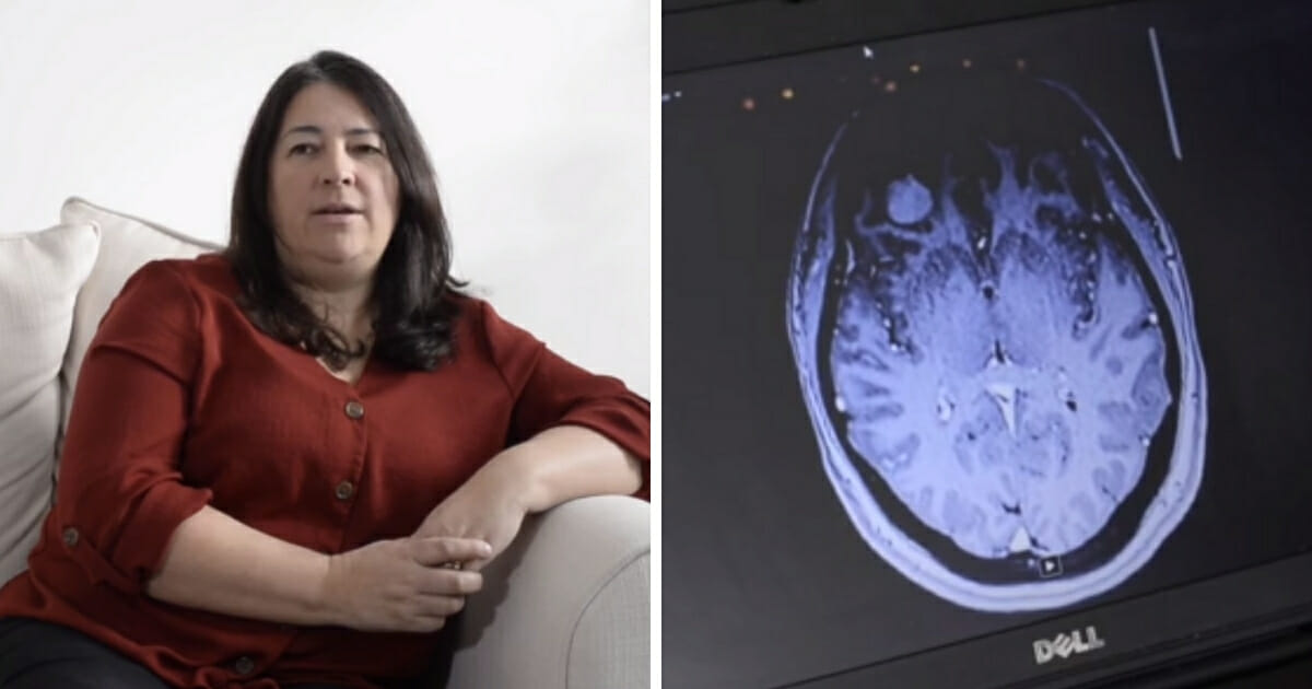 Lee-Tubby sitting, left, and the MRI of her brain, right.