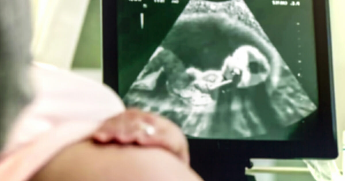 Unborn ultrasound