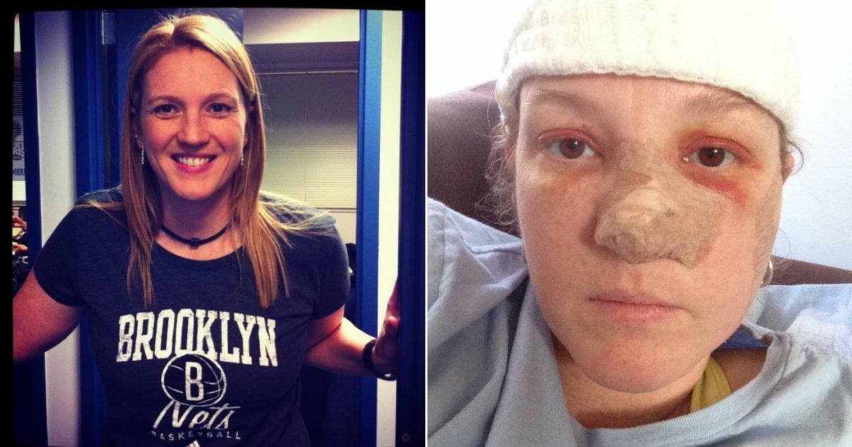 Smiling woman, left, and her after surgery, right.