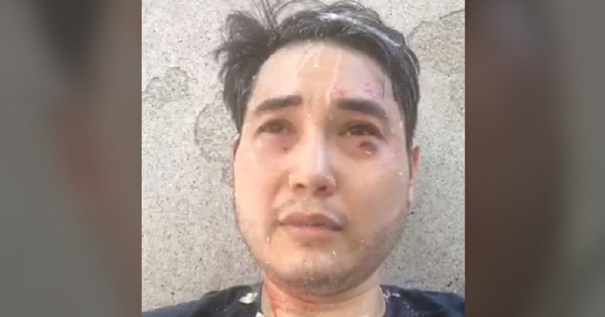 Journalist Andy Ngo with black eye, facial cuts.