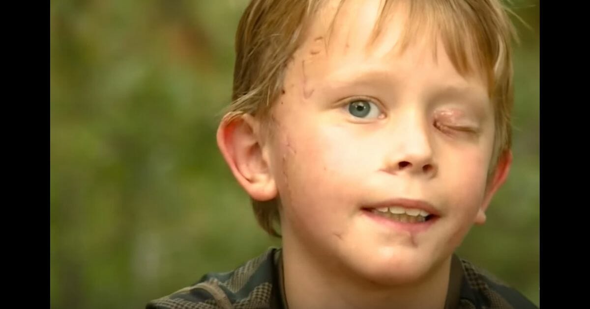 Little boy after mountain lion attack