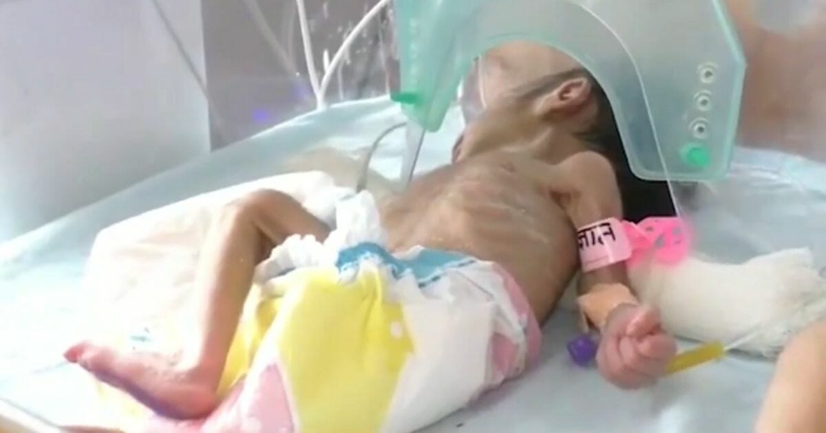 Tiny baby in hospital