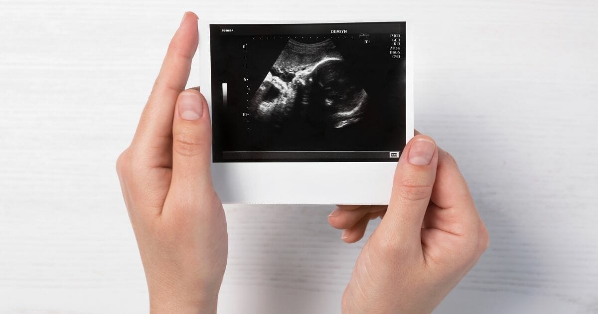 A stock photo of an ultrasound is pictured above. One woman's ultrasound photo shows what looks like her late father kissing her baby.