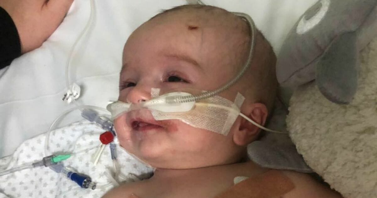 A 1-year-old United Kingdom boy is getting the life-changing surgery he needs after his heartbreaking story went viral.