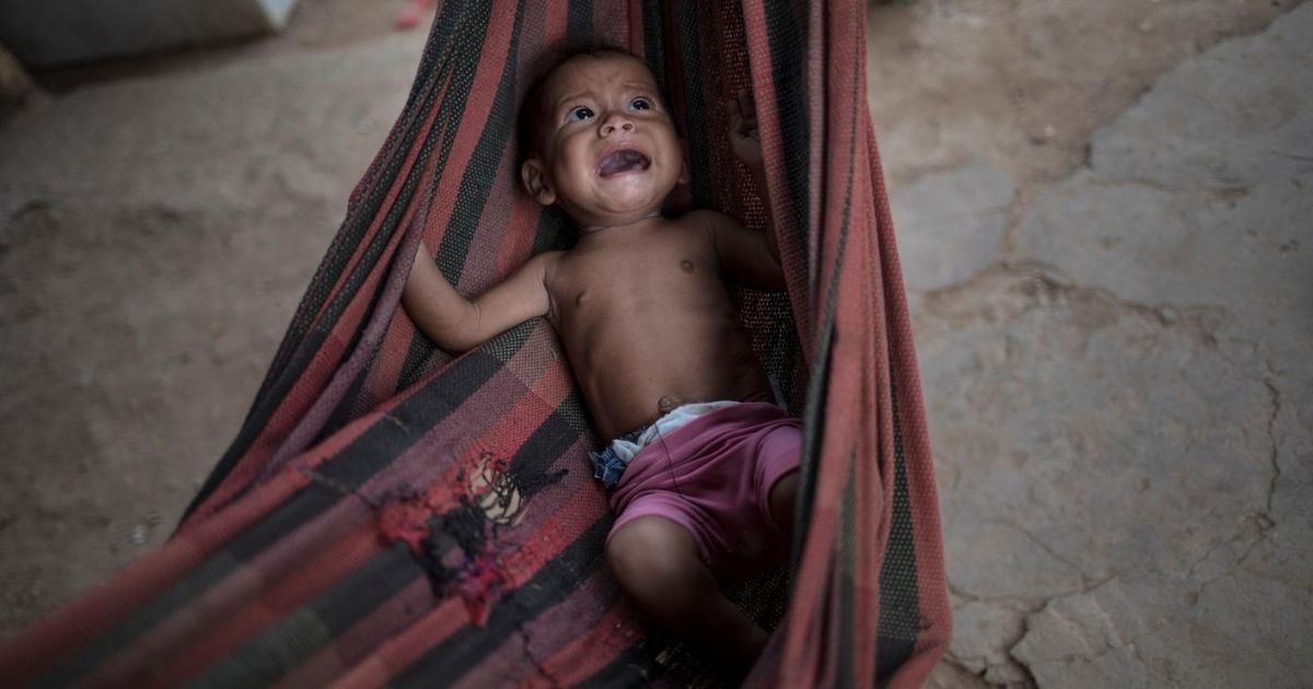 In this Nov. 25, 2019, file photo, Osmery Vargas, who is malnourished, cries in a hammock as she and her 7-year-old sister Yasmery Vargas wait for their mother to return from begging in the street for money and food in Maracaibo, Venezuela.