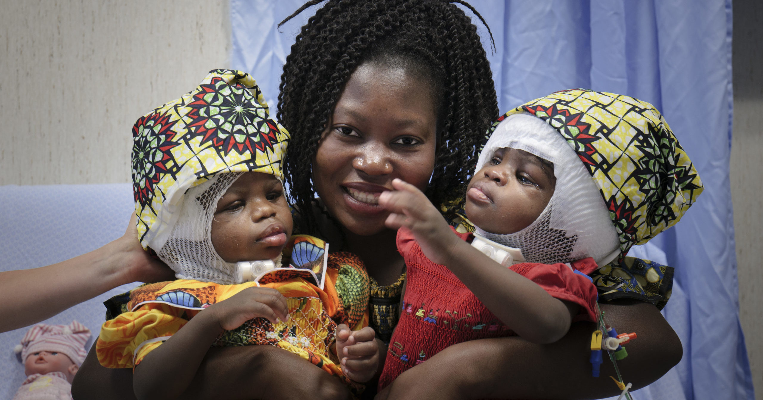 Ermine Nzotto holds her twins, Ervina and Prefina Bangalo, at the Vatican Pediatric Hospital in Rome on June 30, 2020. Doctors at the hospital said on July 7 that they have successfully separated the twins whose skulls were fused back-to-back.