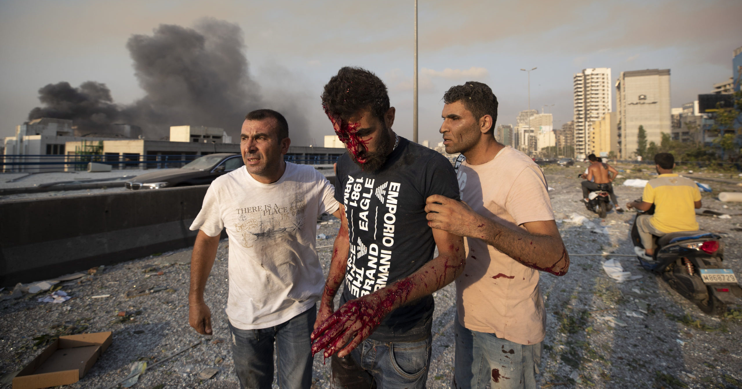 People help a man wounded in a massive explosion in Beirut, Lebanon, on Aug. 4, 2020.
