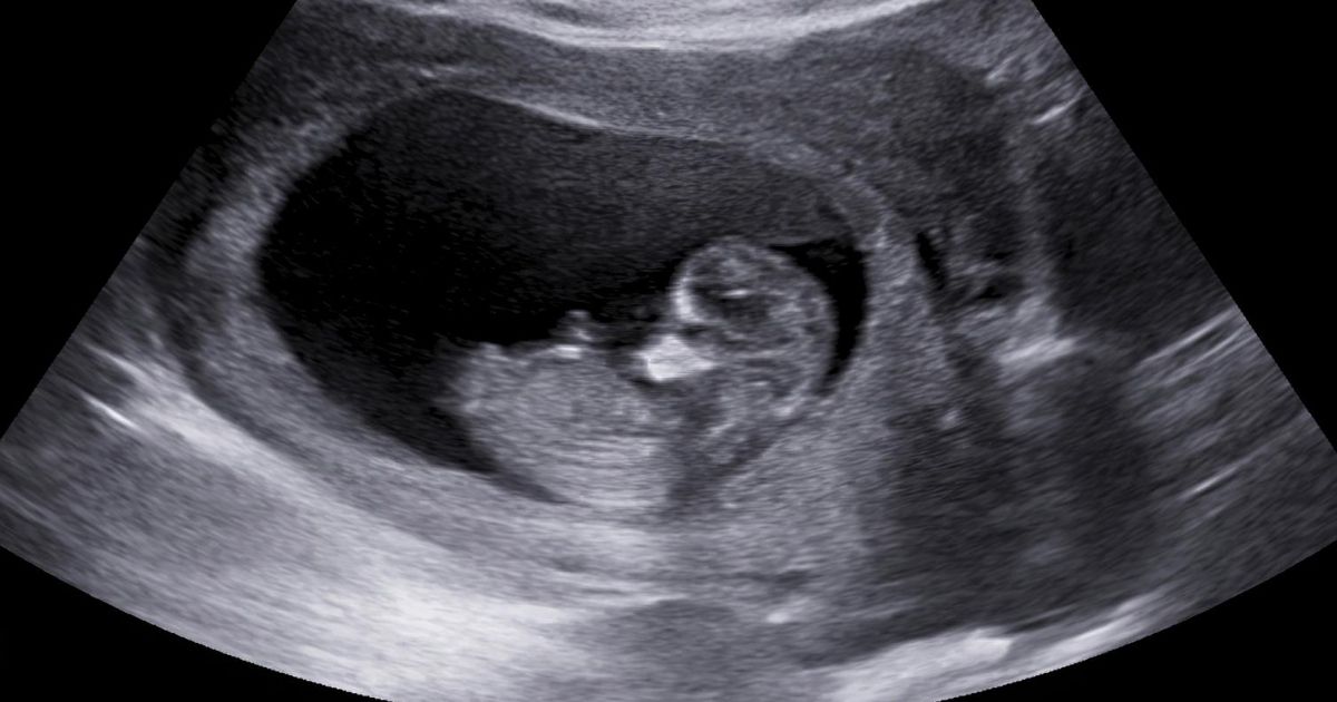An ultrasound of a small baby is seen in the stock photo above. 