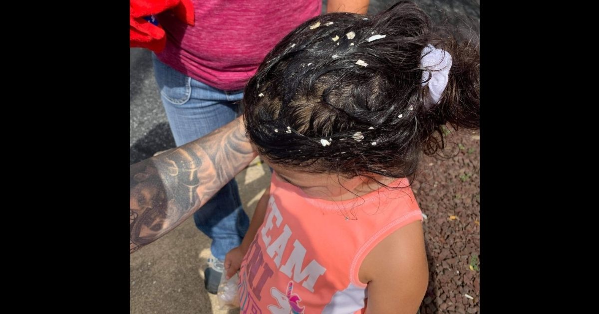 Eggshells are seen in the hair of a little girl after the attack in Wilmington, Delaware.