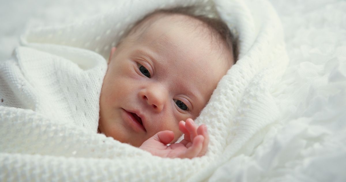 A baby with Down syndrome is seen in this stock image.