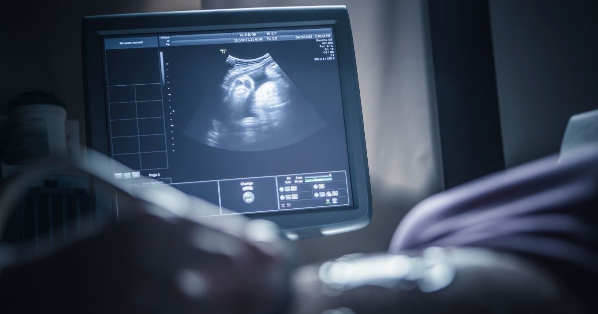 In this stock photo, a pregnant woman has a sonogram. Joe Biden says he supports repeal of the Hyde Amendment, which prevents federal tax dollars from funding most abortions.