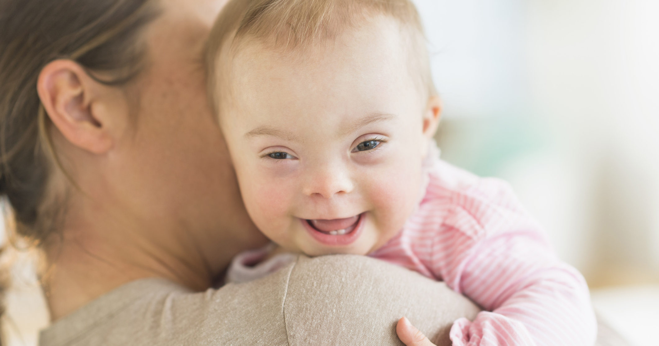 A baby with Down syndrome is pictured in the stock image above.