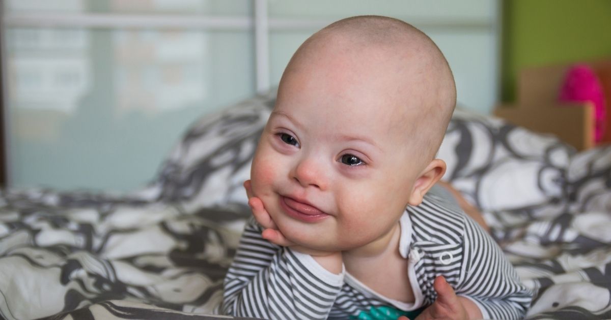 A baby with Down syndrome is pictured in the stock image above.