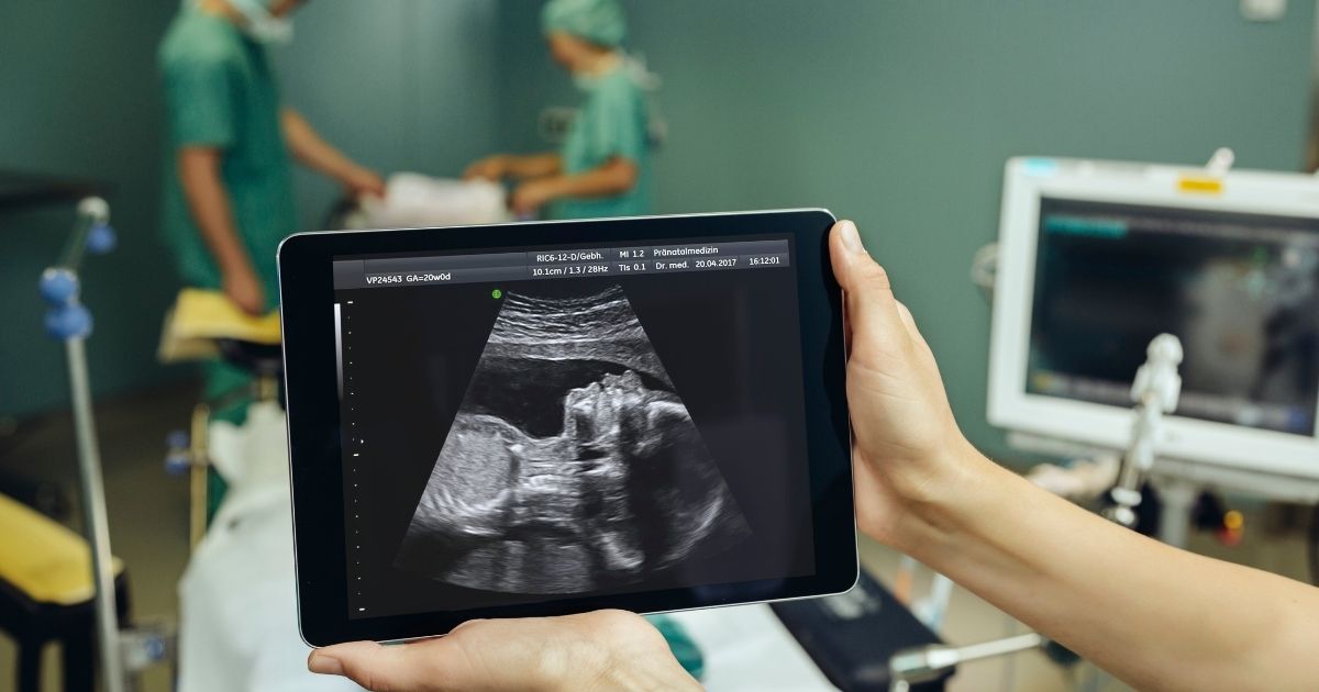 This stock photo portrays an ultrasound image of a fetus in a surgery room.