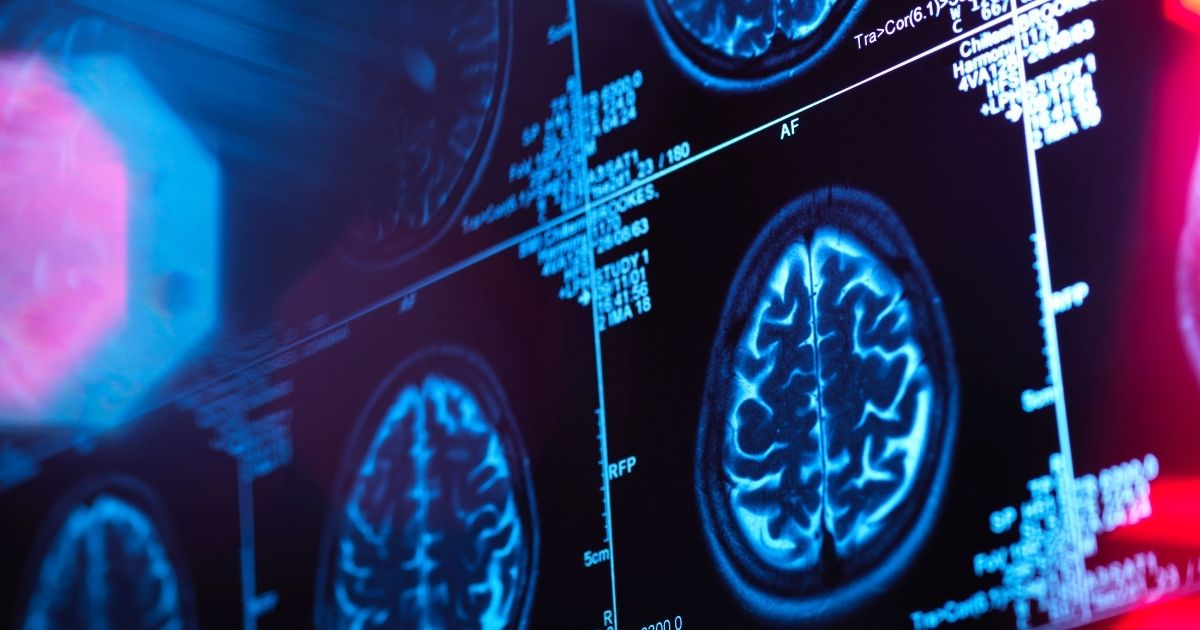 A human brain scan is shown in a neurology clinic.
