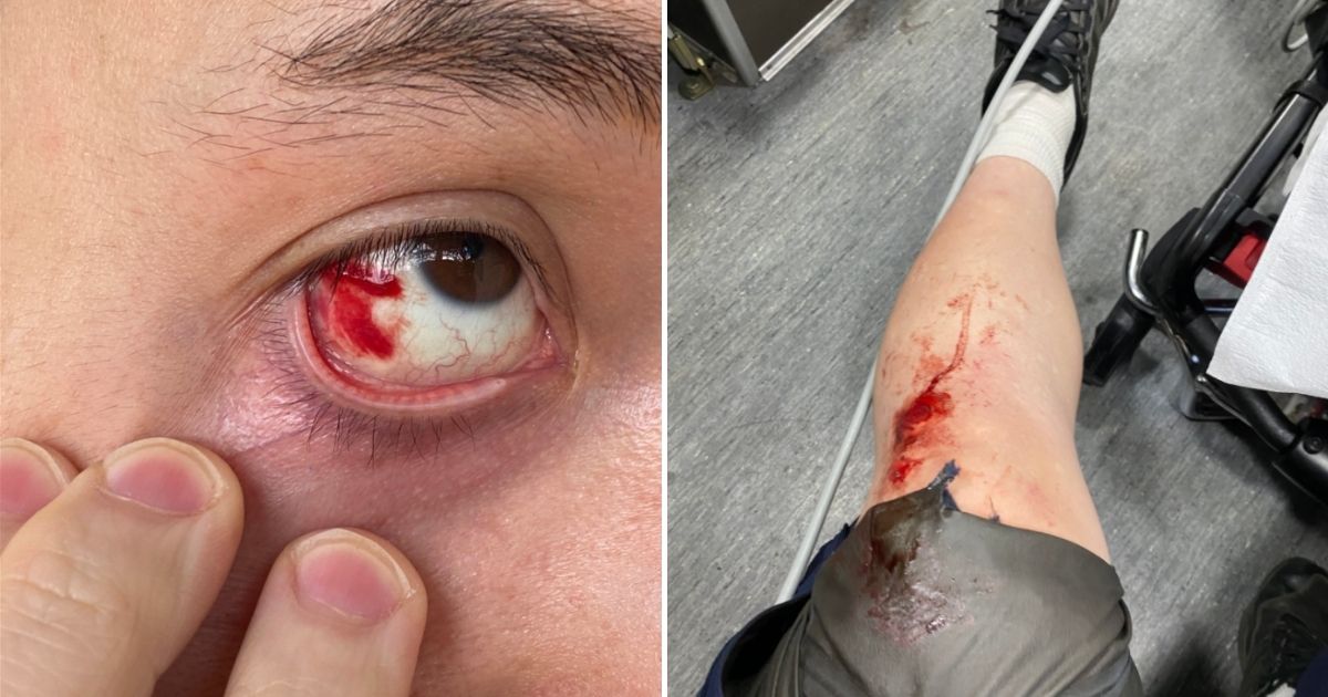 Journalist and author Andy Ngo was reportedly attacked and beaten by antifa demonstrators in Portland, Oregon.