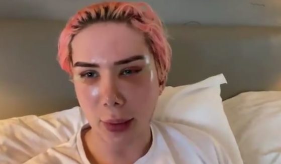 Instagram star Oli London, who identifies as "non-binary," has undergone 18 surgeries to become the world's first "transracial" person.