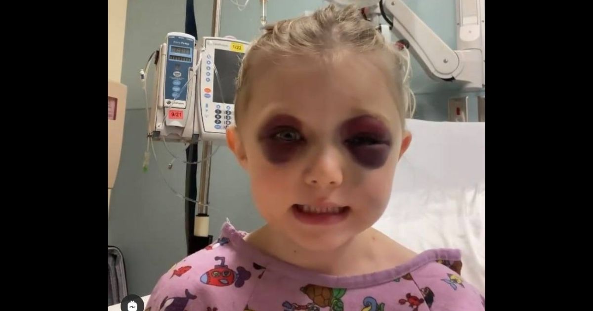 Brooklynn, 3, of Parker, Texas, who ran in front of a galloping horse who tried to avoid her but still kicked her in the head.