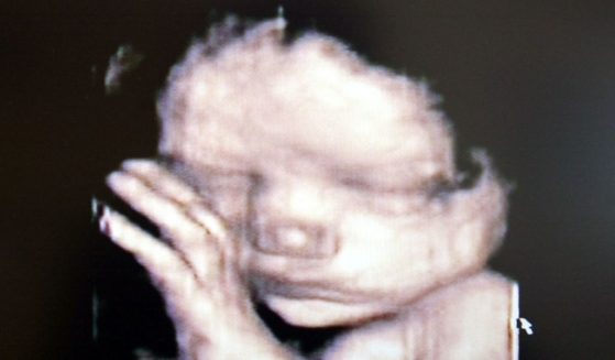 NEW ZEALAND - DECEMBER 01: Stock Photography. A 3D ultrasound showing a baby inside the womb.
