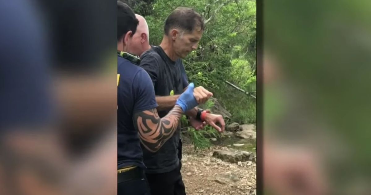 Jay Middleton from Littleton, Colorado, reacts after being bitten by a copperhead snake on a hiking trail in Austin, Texas.