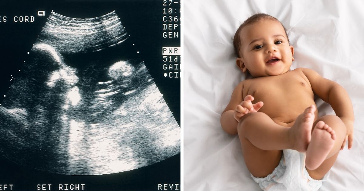 A sonogram image, left; an infant, right.