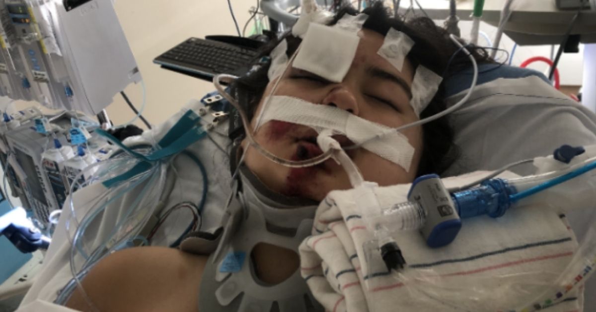 The family of 13-year-old Lily Irigoyen of Escondido, California, is hoping to find an thank the unidentified good Samaritan who performed CPR on the teen after she was struck by a car in May. Doctors said the quick action by the bystander saved Lily's life.