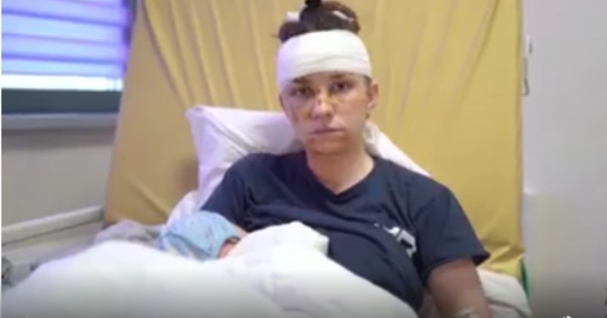 Olga, a 27-year-old Ukrainian mother, shielded her baby from a shrapnel blast in Kyiv, Ukraine, during Russian shelling of the city, and suffered multiple cuts to the head and body.