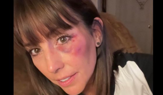 Kristi Moore received a black-eye at a 12-year-old softball game after she made a call as an umpire that a parent disagreed with, leading them to sucker punch her as she left the complex.